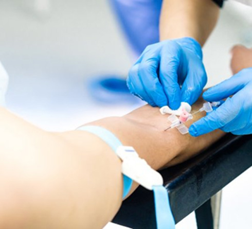 Dentist injecting IV sedation into a patient’s arm