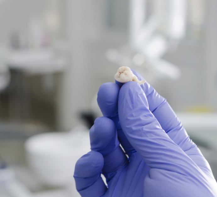 Dentist holding an extracted tooth in a gloved hand